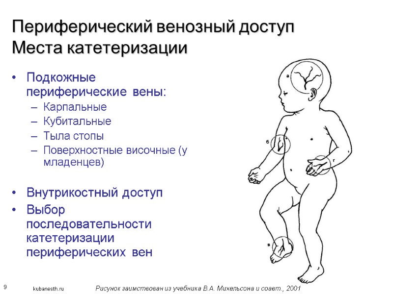 9 Периферический венозный доступ Места катетеризации Подкожные периферические вены: Карпальные Кубитальные Тыла стопы Поверхностные